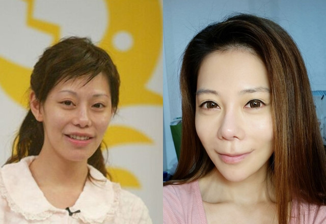 MC nóng bỏng bị biến chứng sau 60 lần "dao kéo" - 2