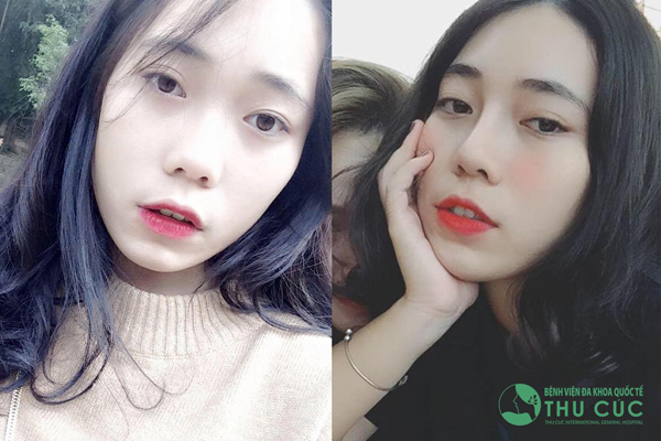 Phẫu thuật thẩm mỹ hiện vẫn là cách làm đẹp toàn năng nhất? - 2