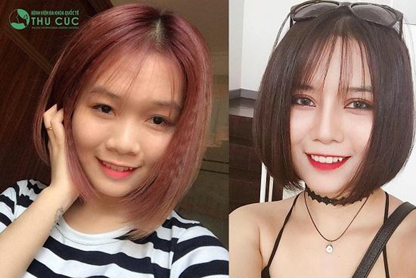 Phẫu thuật thẩm mỹ hiện vẫn là cách làm đẹp toàn năng nhất? - 3