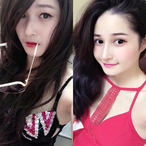 Phẫu thuật thẩm mỹ hiện vẫn là cách làm đẹp toàn năng nhất? - 4