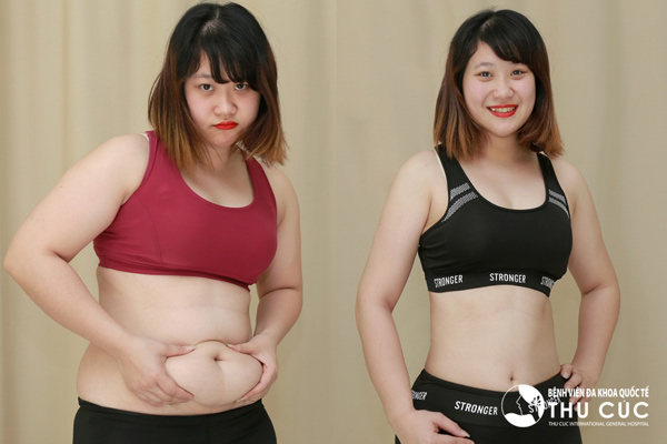 Phẫu thuật thẩm mỹ hiện vẫn là cách làm đẹp toàn năng nhất? - 5