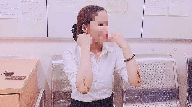 Vì sao tìm được tên cướp kéo lê cô gái hàng chục mét ở Q1? - 2