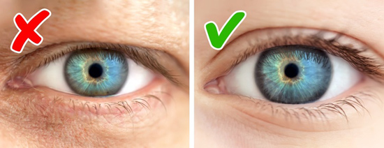 Giật mình với 6 dấu hiệu lão hóa quá nhanh, bạn có không? - 2