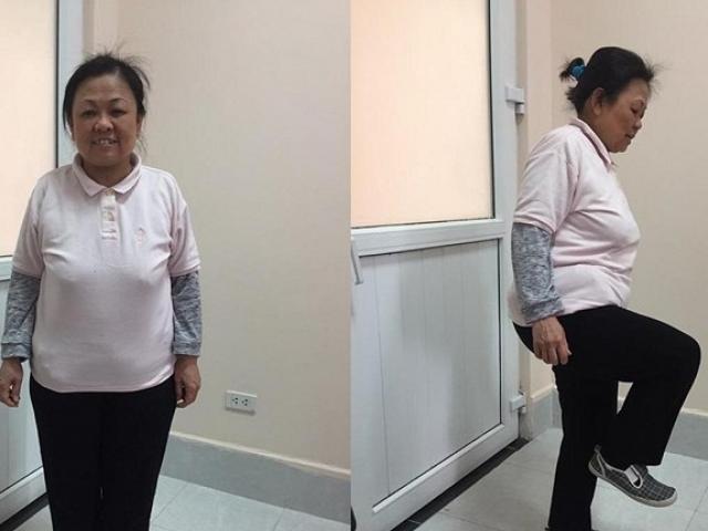 Sức khỏe đời sống - Mang "bệnh lạ" suốt 20 năm sau cú ngã trẹo chân