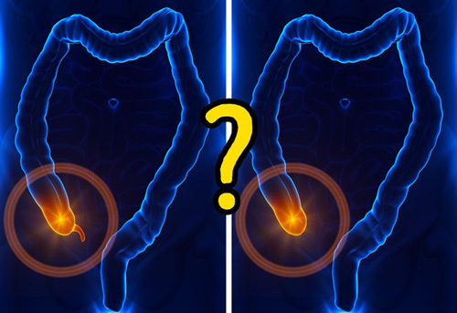 10 khuyết điểm về cấu tạo cơ thể khiến con người gặp vố số rắc rối - 8