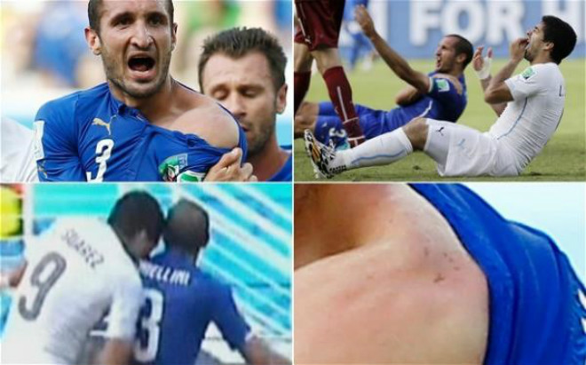 Khoảnh khắc điên rồ World Cup: Suarez “hóa ác quỷ” cắn trộm Chiellini - 1