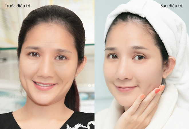 "Bà mối" Cát Tường tiết lộ bí kíp trẻ đẹp "đốn tim" người nhìn ở tuổi 40 - 3