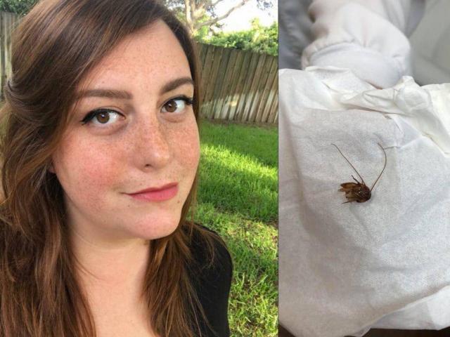 Phi thường - kỳ quặc - Con vật “sống dai như đỉa” trong tai cô gái Mỹ