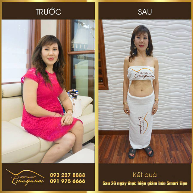 3 điều tưởng không sai mà “sai không tưởng” về giảm cân - 5