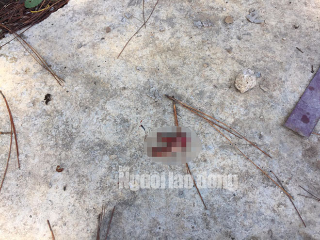 Tưởng lựu đạn giả cầm chơi, không ngờ nổ thật - 3