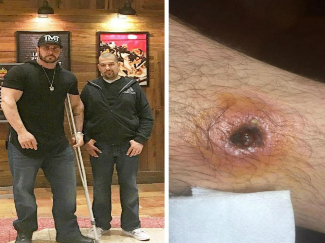 Thể thao - "Tay chơi" Mayweather bị bắn: Vệ sĩ lộ vết đạn rợn người