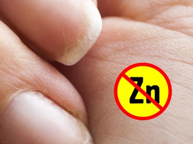 Sức khỏe đời sống - Chỉ cần vài giây để biết dấu hiệu trên bàn tay báo trước bệnh nan y