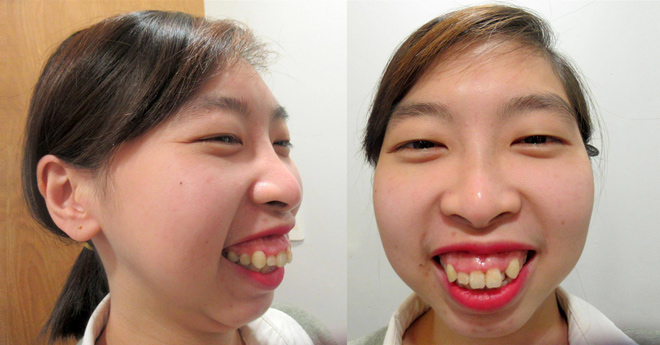 Chị gái song sinh Nam Em sởn gai ốc trước cô gái bị “rớt hàm” - 2