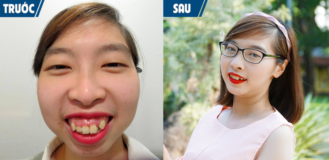 Chị gái song sinh Nam Em sởn gai ốc trước cô gái bị “rớt hàm” - 4