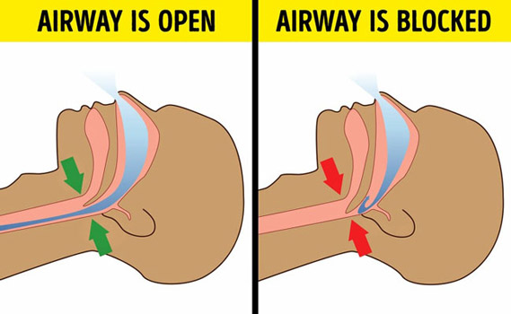 Nếu bạn luôn bị tỉnh giấc cùng một thời điểm vào ban đêm thì đây chính là lý do - 3