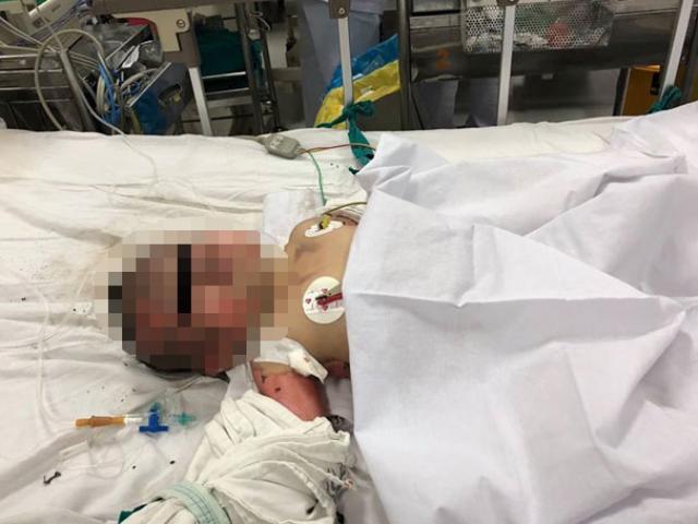 Tin tức trong ngày - Mẹ mang bầu và con gái 15 tháng tuổi bị bỏng gas thương tâm