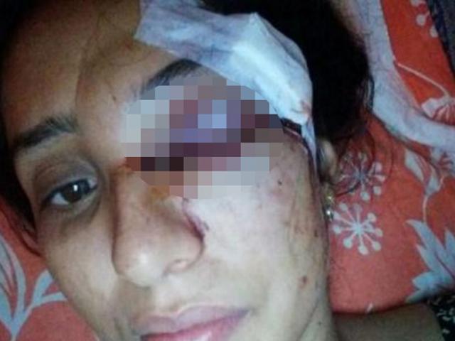 Pháp luật - Gã chồng trăng hoa đánh vợ đến sảy thai, mù mắt vì không được mua ôtô