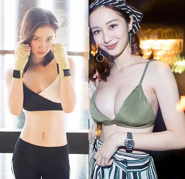 Hot girl tự tin diện nội y đến nơi đông người. Đây là hình ảnh so sánh trước và sau khi thẩm mỹ của cô.