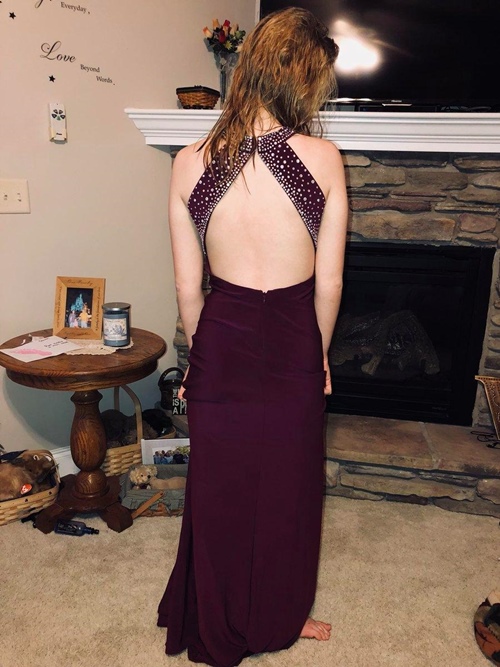 Chia tay vì bạn trai chê bai chiếc váy hở lưng - 2