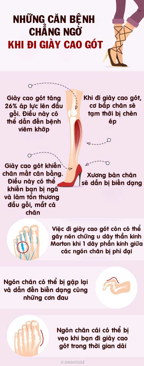 Bạn sẽ mắc những bệnh chẳng ngờ này nếu đi giày cao gót thường xuyên - 1