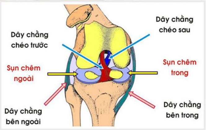 Đứt dây chằng đầu gối, nỗi ám ảnh với bất cứ ai - 1