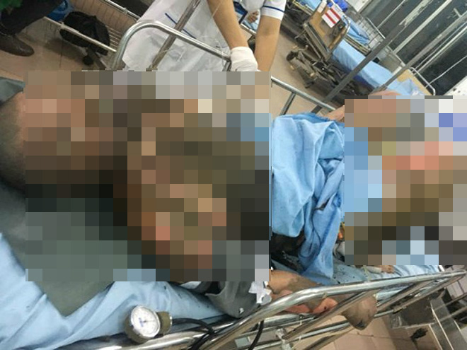 1 thanh niên tưới xăng tự thiêu tại công viên Văn Miếu - 1