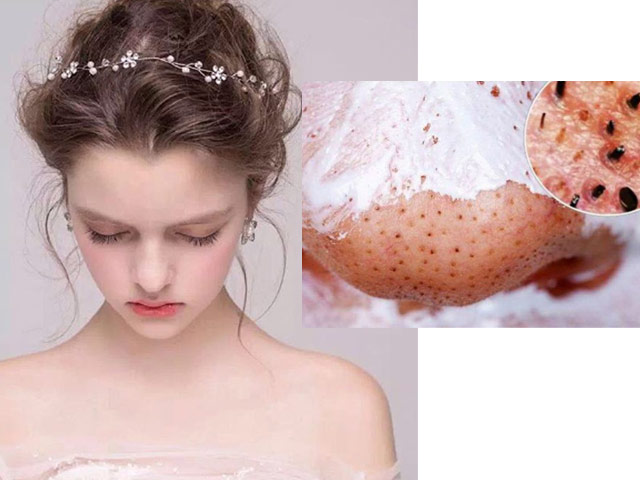 Làm đẹp - Tự thổi bay mụn đầu đen tại nhà chỉ với 2 nghìn đồng