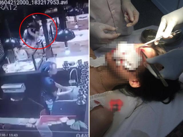 Tin tức trong ngày - Thực hư clip 2 cô gái bị nam thanh niên ném cốc, đánh túi bụi ở quán ăn