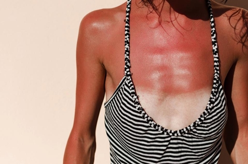 5 lý do không ngờ khiến vòng 1 chảy xệ - 5