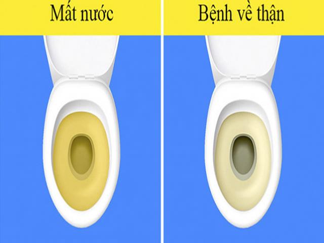 Sức khỏe đời sống - Đừng bỏ qua 7 dấu hiệu đáng báo động khi nạp quá nhiều muối vào cơ thể