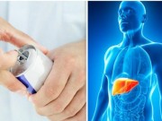 Sức khỏe đời sống - 9 thói quen cực nguy hại nhiều người Việt vẫn làm mỗi ngày mà không biết