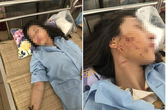 Vụ cô gái bị lột sạch đồ đổ nước mắm, bột ớt: Có tin nhắn qua lại - 2