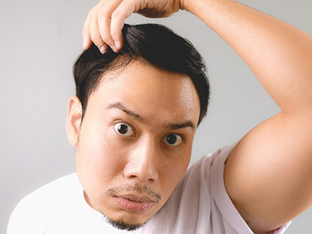 Làm đẹp - Những "thủ phạm" gây ra rụng tóc ở nam giới, ai cũng cần phải biết