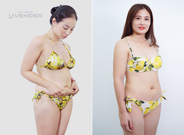 Dở khóc dở cười khi người béo lần đầu thử diện bikini - 1