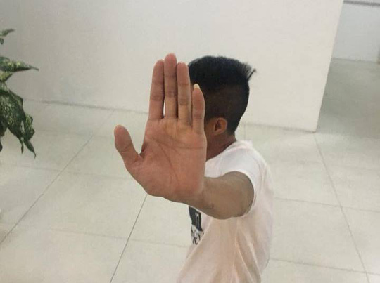 Khách Nga bức xúc vì hành động ném con chó từ tầng 24 xuống đất - 1