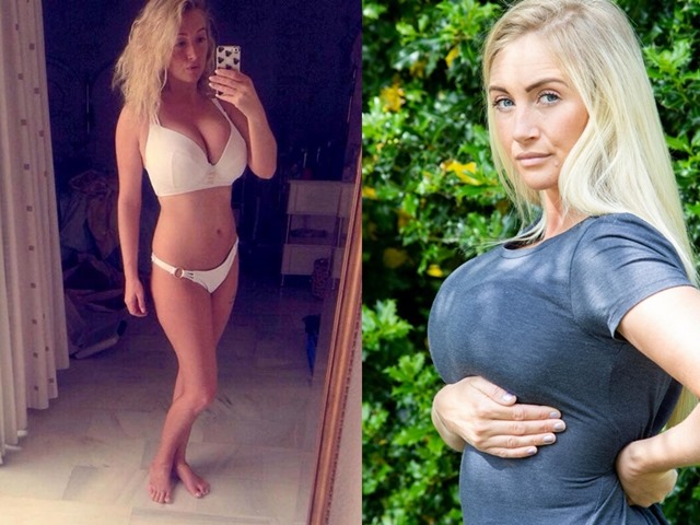 Bí quyết làm đẹp - Nữ y tá đau khổ vì mãi không được thu nhỏ ngực