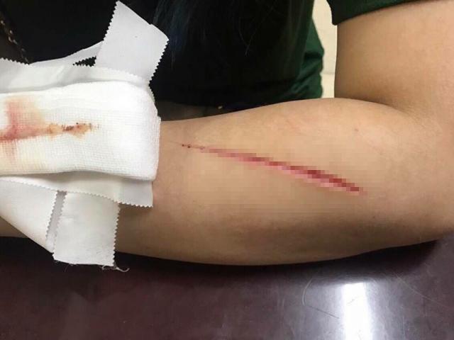 Tin tức trong ngày - Sự thật khó tin vụ tung tin đồn cướp rạch tay ở Hà Nội