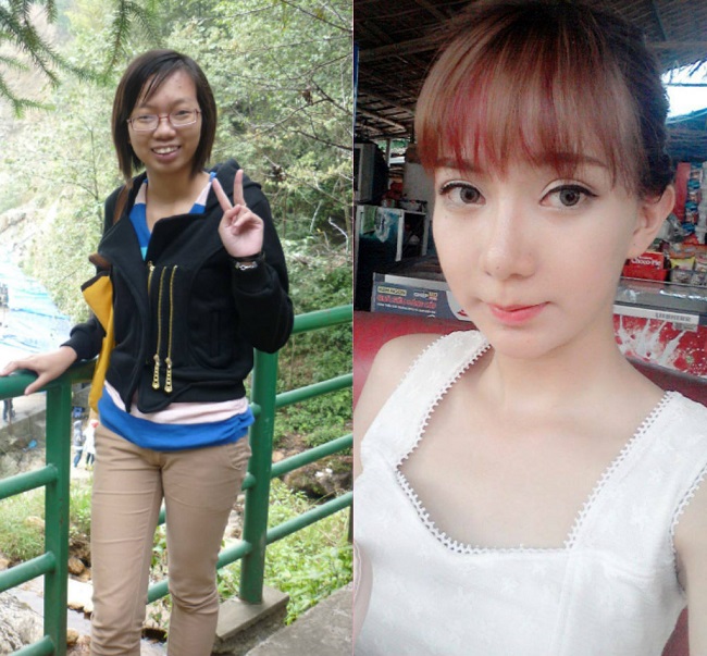 3. Cũng là một cô gái đến từ Nam Định, Lưu Tuyết Nhung &#34;hóa thiên nga&#34; nhờ phẫu thuật thẩm mỹ. Chi phí được tài trợ lên đến 1 tỷ đồng.&nbsp;
