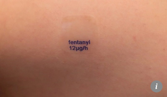 Bé gái chết vì bị dính miếng dán giảm đau từ mẹ - 2