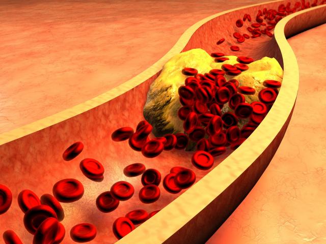 Sức khỏe đời sống - Ăn gì để giảm mỡ máu?