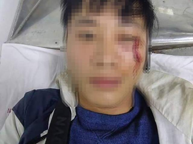 Pháp luật - Shipper tố bị khách đánh chảy máu mặt vì giao hàng muộn