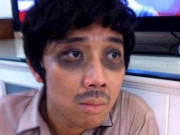 Mất ngủ vì mèo hoang