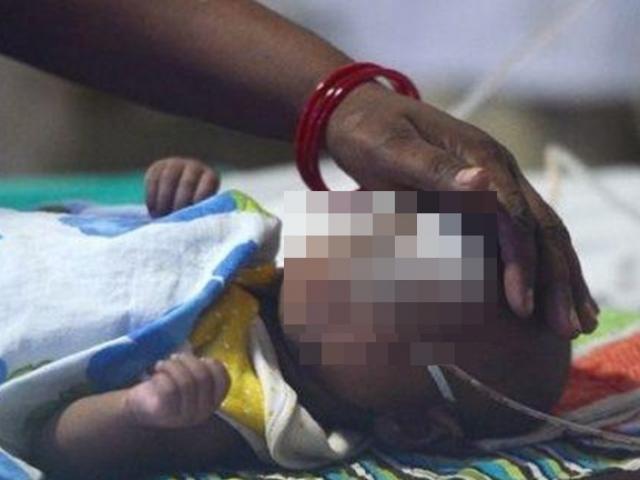 Sức khỏe đời sống - Tự cắt bao quy đầu cho con tại nhà, cha mẹ sốc nặng khi nhận hậu quả bi thảm