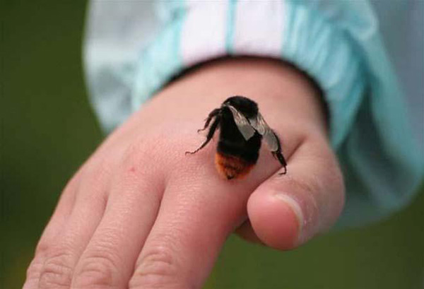 Nổi mề đay - Nguyên nhân, triệu chứng và cách điều trị hiệu quả - 2