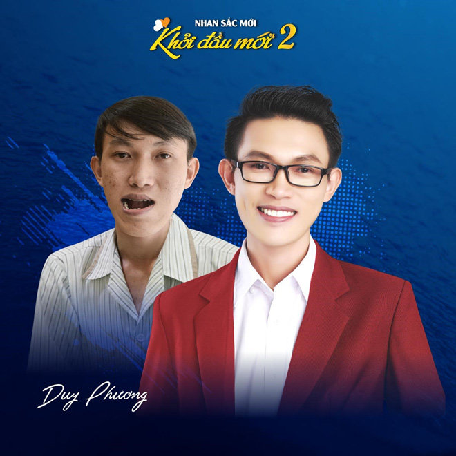 Top 10 nhan sắc dao kéo cực đỉnh khiến nhiều người trầm trồ - 1