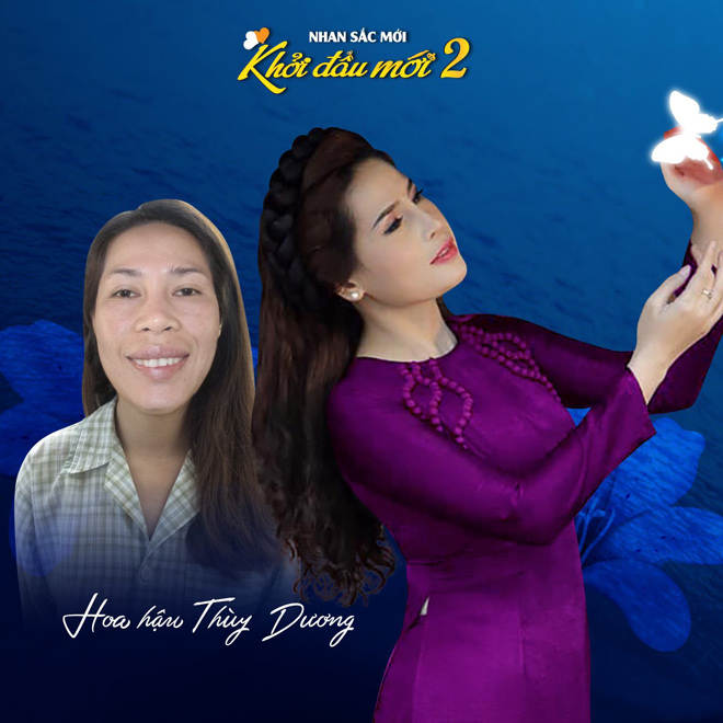 Top 10 nhan sắc dao kéo cực đỉnh khiến nhiều người trầm trồ - 5