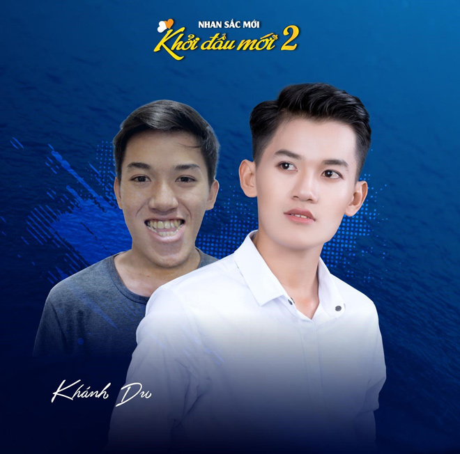 Top 10 nhan sắc dao kéo cực đỉnh khiến nhiều người trầm trồ - 6