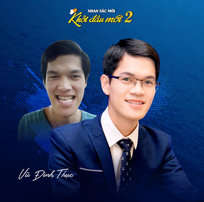 Top 10 nhan sắc dao kéo cực đỉnh khiến nhiều người trầm trồ - 2