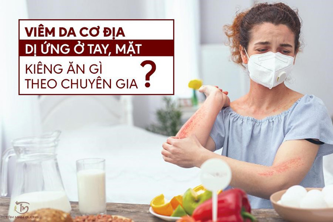 Viêm da cơ địa dị ứng ở tay, chân, mặt người lớn kiêng ăn gì? - 1