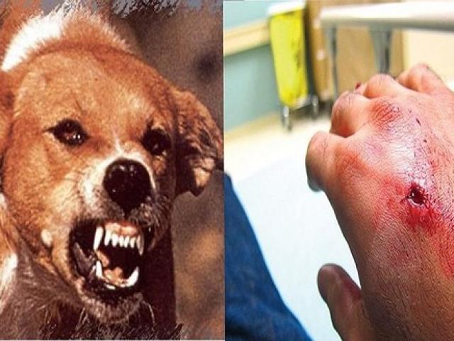 Pháp luật - Nhân viên ghi số nước bị chó cắn, chủ chó đánh vỡ đầu